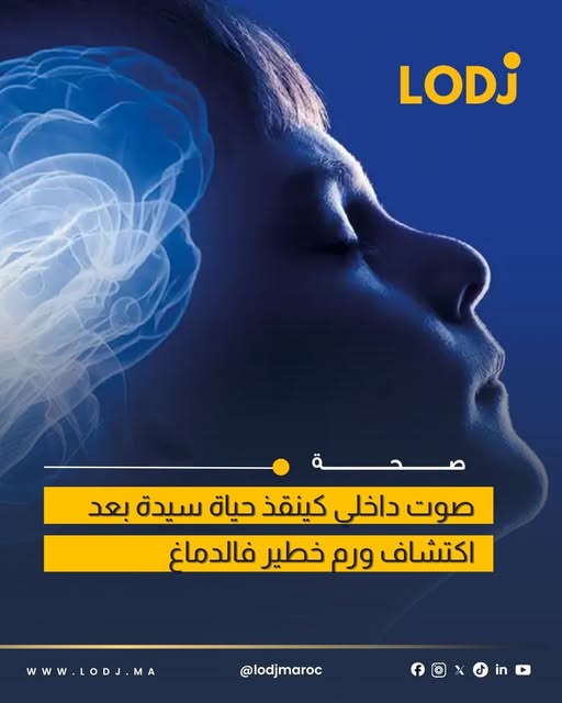 اكتشاف ورم دماغي بعد شكاية مريضة من سماع أصوات داخلية