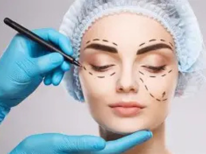 الجراحة التجميلية في المغرب.. من خيار استثنائي إلى ظاهرة تتسع تحت تأثير مواقع التواصل