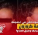 Care Week : أطفال بتشوه خلقي في الجمجمة، متلازمة كروزون،  ما هي أسبابها وطرق العلاج؟