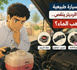 حرارة السيارة طبيعية لكن ماء الرديتر ينقص.. أين يذهب الماء؟