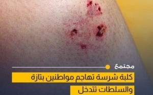 هجوم كلبة على مواطنين يثير القلق بمدينة تازة