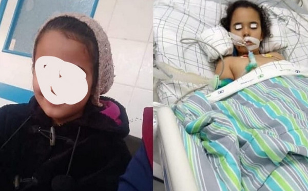 عملية جراحية تدخل طفلة في غيبوبة