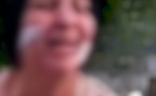 "مولات 88 غرزة": قصة ضحية العنف وصرخة في وجه العدالة المجتمعية