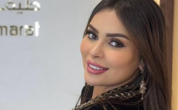 صفاء حبيركو توضح موقفها من الغناء وتؤكد تمسكها بمسارها التمثيلي