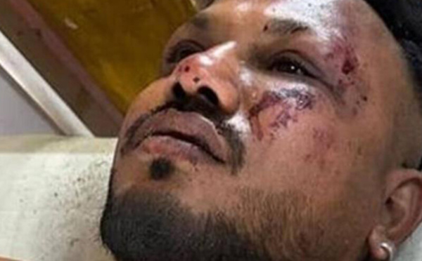 الناجي الوحيد من حادث تحطم طائرة «إير إنديا»: قصة صمود وسط الحطام