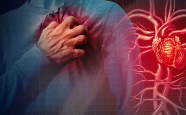 كيفية التصرف عند الاشتباه بالنوبة القلبية خلال الطقس الحار: نصائح طبية مهمة