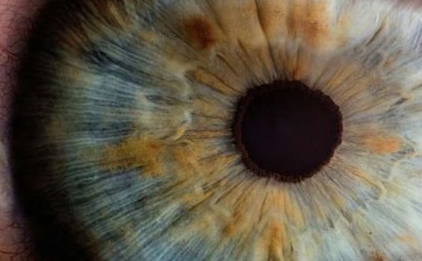 دراسة كندية: فحص العين قد يكشف خطر أمراض القلب وسرعة الشيخوخة