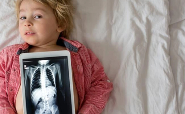 نيوزيلندا: جراحون ينقذون طفلاً ابتلع 100 مغناطيس اشتراها عبر الإنترنت