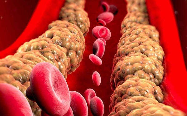 نصائح مثبتة علميًا لتقليل الكوليسترول وتحسين القلب بلا أدوية