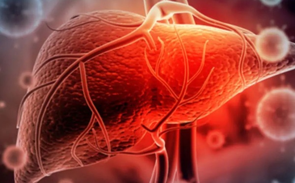 الكبد الدهني: 10 أطعمة طبيعية لتقليل الدهون وتحسين وظائف الكبد