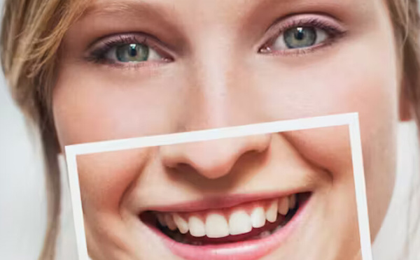 بيكربونات الصوديوم وتبييض الأسنان: بين الفوائد والمخاطر