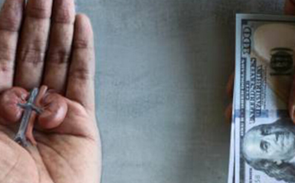 شرطة البنغال الغربية تُحبط مخططاً لبيع كلية امرأة دون علمها