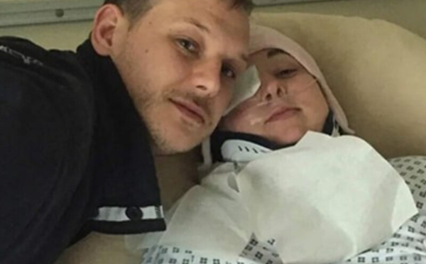 حالة نادرة تصيب امرأة بريطانية بكسور خطيرة في الرقبة إثر تثاؤب عفوي