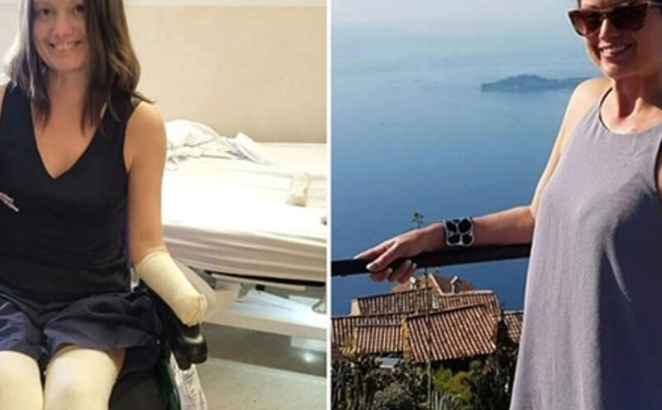 من ألم بسيط إلى مأساة صحية… عدوى نادرة تبتر أطراف امرأة كندية وتنقذ حياتها