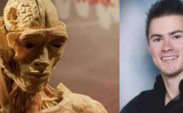 صدمة أم أمريكية في متحف "Real Bodies" بعد اكتشاف جثة تشبه ابنها الراحل