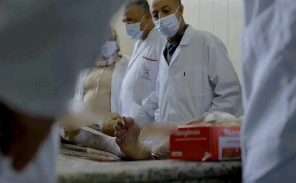 ​البرلمان المغربي يُطلق مهمة استطلاعية حول وضعية الطب الشرعي في المملكة