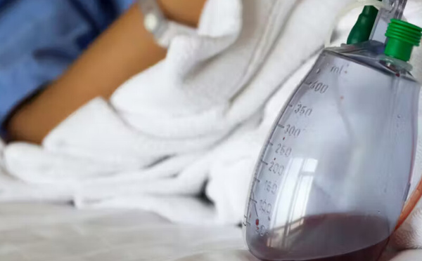 الدرين من نوع ريدون: دوره وكيفية العناية به بعد العمليات الجراحية