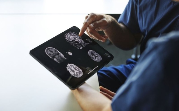 دراسة علمية تكشف علاقة غير متوقعة بين حجم الرأس وخطر الخرف