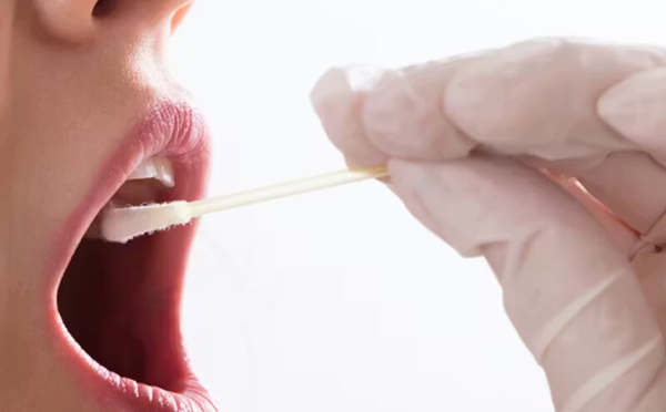 علماء إماراتيون يكشفون علاقة بين البكتيريا الفموية والسمنة