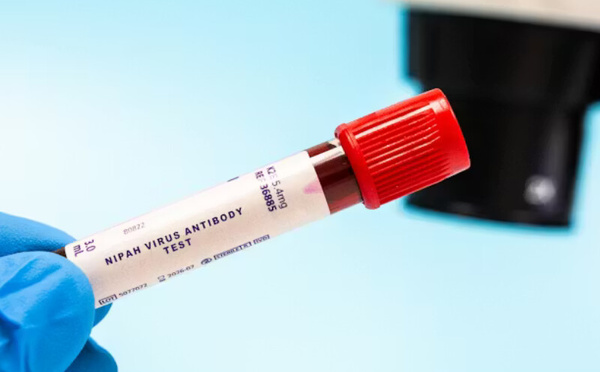 فيروس نيباه: تهديد صحي عالمي بلا لقاح أو علاج