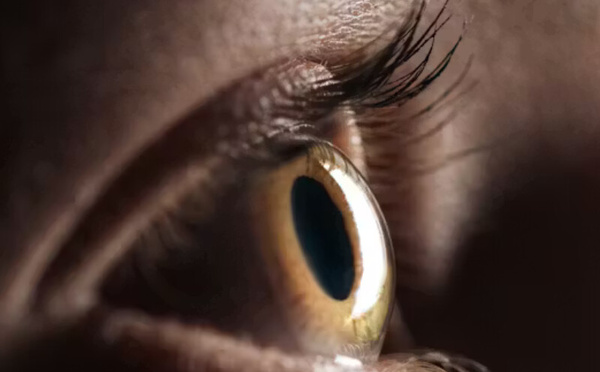الزَّرَق (الغلوكوما): مرض صامت قد يؤدي إلى فقدان البصر إذا لم يُكتشف مبكراً