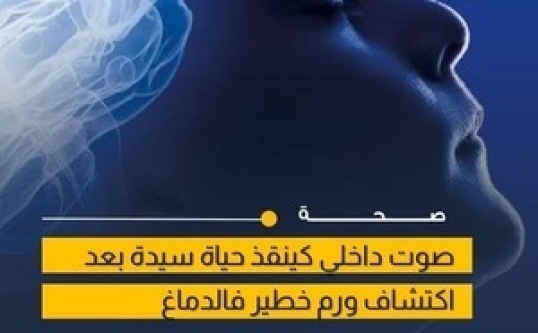 اكتشاف ورم دماغي بعد شكاية مريضة من سماع أصوات داخلية