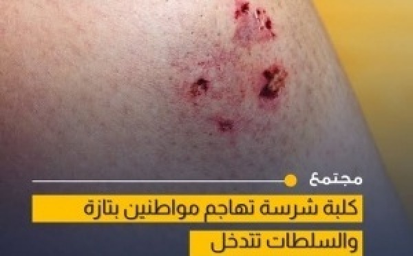 هجوم كلبة على مواطنين يثير القلق بمدينة تازة