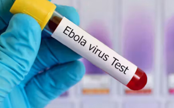 شفاء مريض من إيبولا في ألمانيا يسلّط الضوء على تطور العلاجات والبروتوكولات الطبية