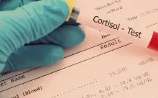 الكورتيزول.. هرمون لا ينبغي محاربته بل فهمه