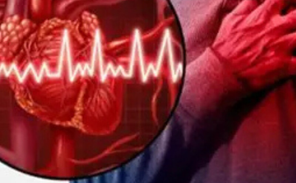 بعد الإصابة بالجلطة القلبية.. أسئلة كثيرة عن الحياة من جديد