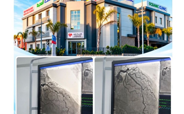 OceanicClinic El Hana تنجز تفتيتاً داخل الشريان التاجي لعلاج تكلسات شديدة لدى مريض فوق 70 عاماً