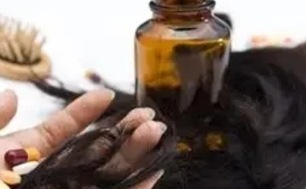 تساقط الشعر.. هل تستطيع المكملات الغذائية إيقافه وإعادة إنباته؟