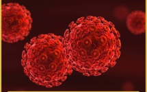 فيروس نقص المناعة البشرية حالة جديدة  بعد زرع نخاع العظام