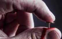 Care Week :  أطفال لا بشعرون بالألم، اضطراب سيبا ما هي أعراضه وطرق العلاج؟
