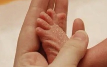 وصفات طبيعية تخلص رضيعك من جفاف الجلد وتشققه