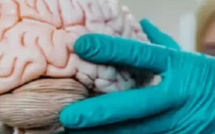 تأثير الاستخدام المفرط للهواتف الذكية على صحة الدماغ: تحذيرات من جامعة هارفارد