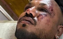 الناجي الوحيد من حادث تحطم طائرة «إير إنديا»: قصة صمود وسط الحطام