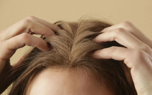 أحدث التقنيات لعلاج مشاكل فروة الرأس: ابتكارات تكنولوجية تعزز صحة الشعر