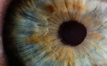 دراسة كندية: فحص العين قد يكشف خطر أمراض القلب وسرعة الشيخوخة