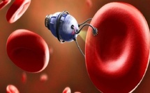 علماء صينيون يبتكرون جسيمات نانوية للوقاية من الجلطات  الدموية بطريقة أكثر أمانًا