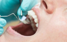 الحكومة المغربية توسع قائمة الأعمال الخاضعة لعقود القانون العادي