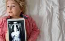 نيوزيلندا: جراحون ينقذون طفلاً ابتلع 100 مغناطيس اشتراها عبر الإنترنت