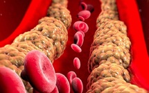 نصائح مثبتة علميًا لتقليل الكوليسترول وتحسين القلب بلا أدوية