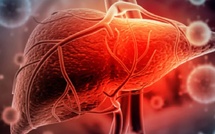 الكبد الدهني: 10 أطعمة طبيعية لتقليل الدهون وتحسين وظائف الكبد