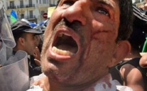 الجزائر بين التزامات مكافحة التعذيب والانتهاكات الموثقة