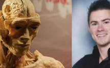 صدمة أم أمريكية في متحف "Real Bodies" بعد اكتشاف جثة تشبه ابنها الراحل