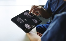 دراسة علمية تكشف علاقة غير متوقعة بين حجم الرأس وخطر الخرف