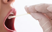 علماء إماراتيون يكشفون علاقة بين البكتيريا الفموية والسمنة