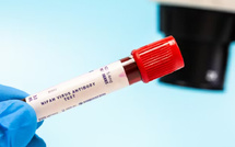 فيروس نيباه: تهديد صحي عالمي بلا لقاح أو علاج