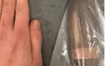 حادث قذيفة مدفعية من الحرب العالمية الأولى يثير الاستنفار في مستشفى رانغوييل بـتولوز